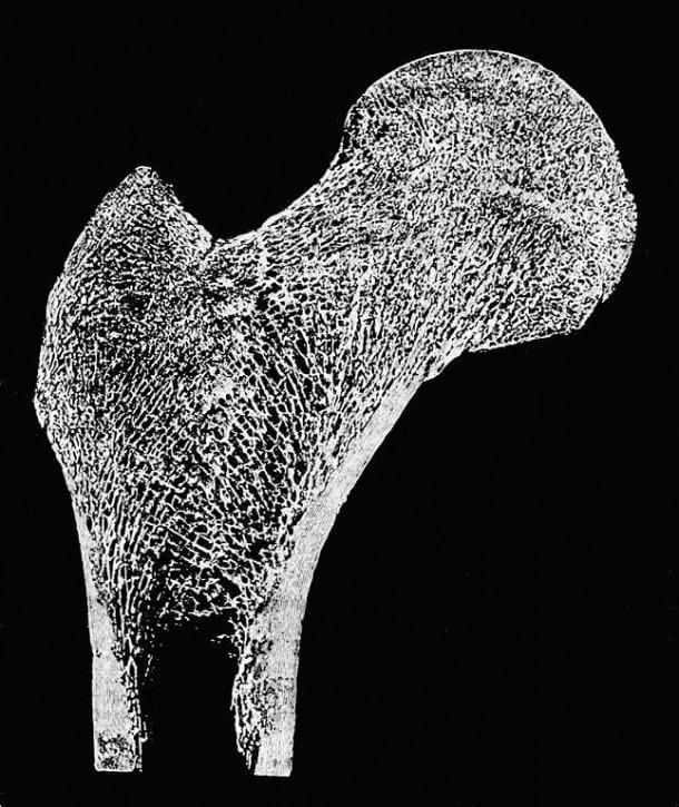3-d-printing-of-artificial-bone