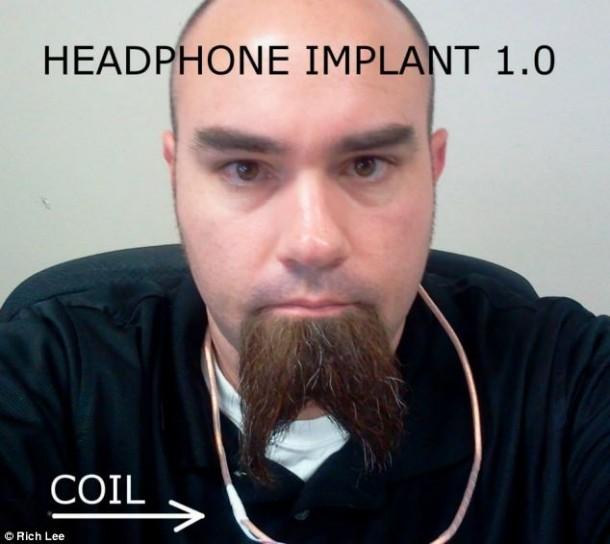 里奇·李和他的植入物