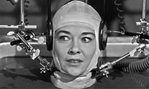 头部移植 - 我们有多远