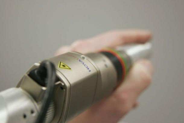 用现代激光技术去除纹身爱游戏ayx体育