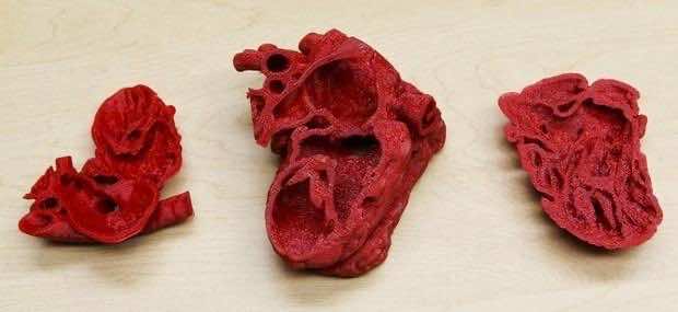 3 d-printed_heart (6)