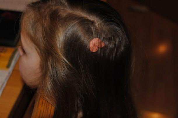 8。口香糖的头发!