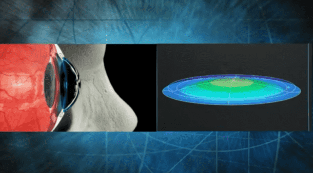 RAZAR Riflescope引入按钮Zoom2