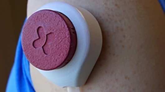 不使用针——HemoLink血液样本