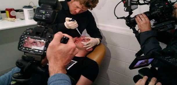 这些眼药水传授临时夜视4