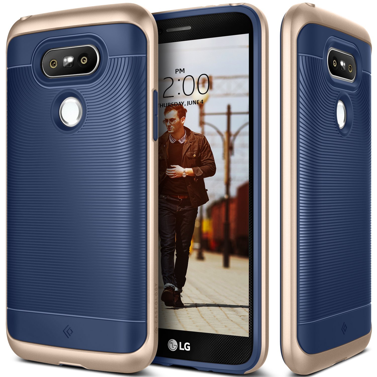 LG G5的10个最佳案例（10）