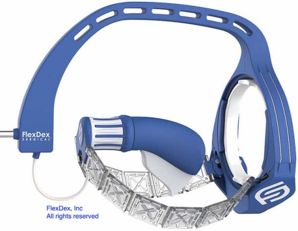 FlexDex腹腔镜器械平台改造微创手术