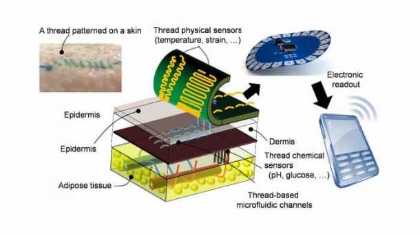 图显示了智能缝合线的工作方式。学分：塔夫茨大学。