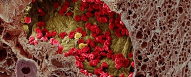 图片学分：惠康图像