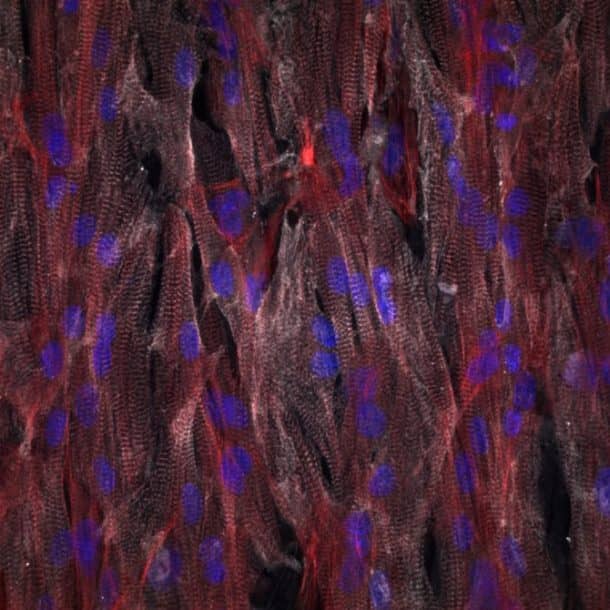 芯片上的心脏组织的特写(来源:约翰·林德,弗朗西斯科·s . Pasqualini疾病生物物理学集团/哈佛大学)