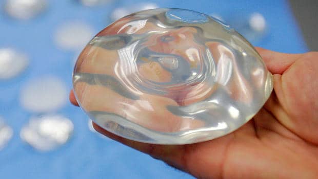 breastimplant