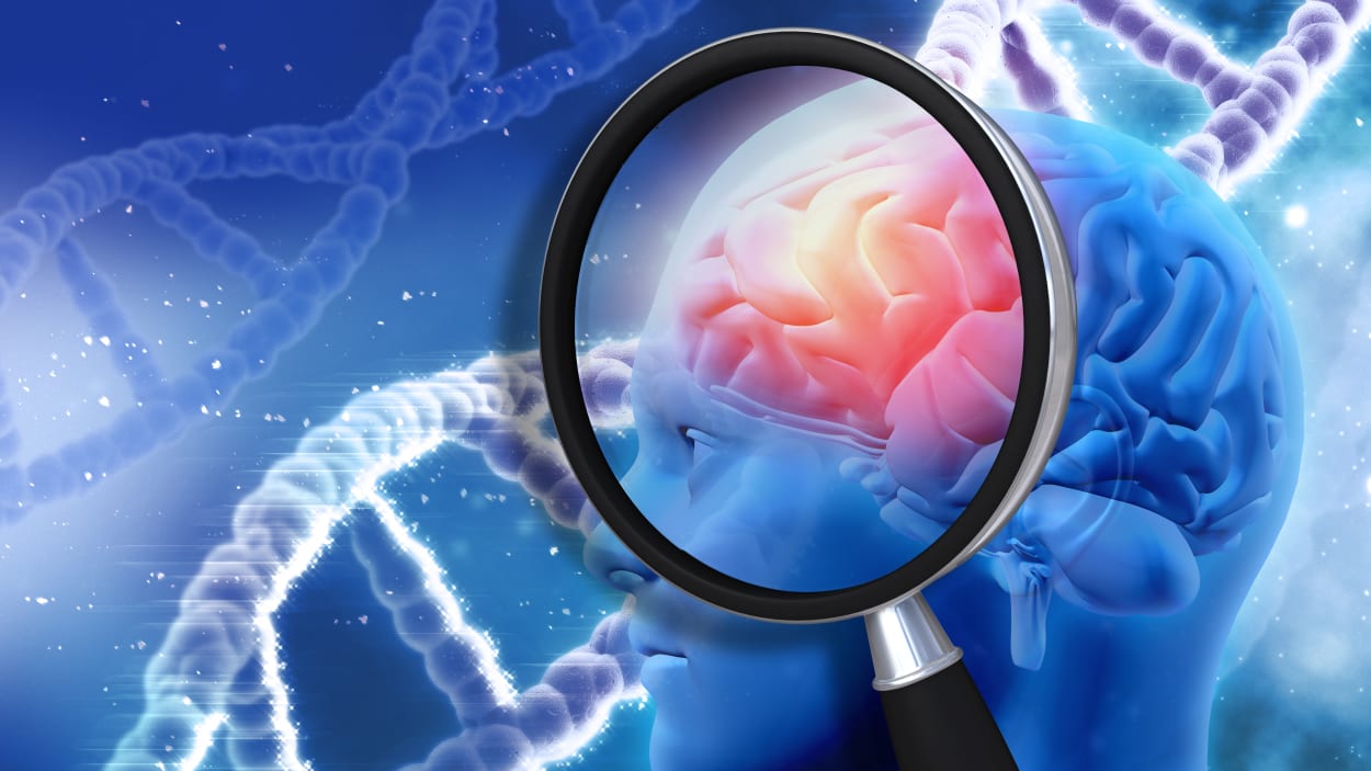 阿尔茨海默氏症