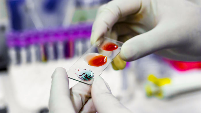 细菌酶用于将A型血液转化为O型O