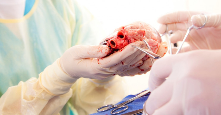 温暖灌注是一种有效的心脏移植技术