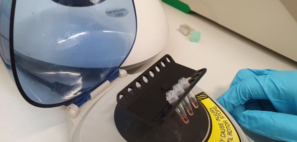 SAMBA II机器可以在90分钟内诊断COVID-19患者