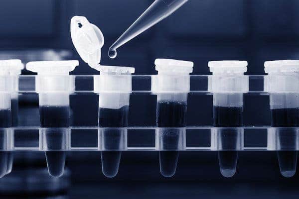 麻省理工学院Duo开发了6美元的CRISPR冠状病毒检测测试