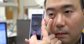 这个程序可以使用智能手机检测贫血的迹象