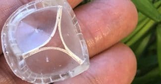 Polivalve可以完全改变心脏直视手术