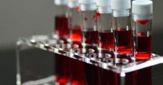 O型血最不容易受到COVID-19的影响