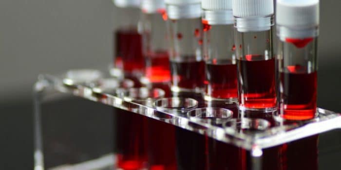 O型血液最不可能受到Covid-19的影响