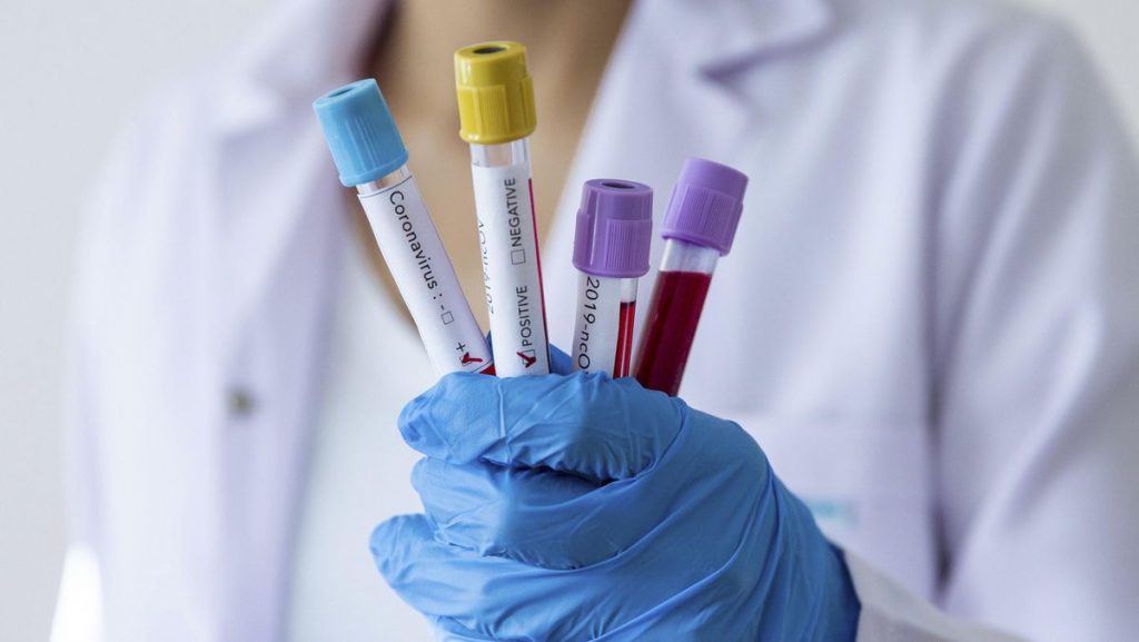 O型血液最不可能受到Covid-19的影响